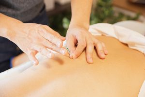 Acupuncture Clinic Auckland NZ