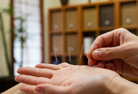 Best Physiotherapy in Auckland